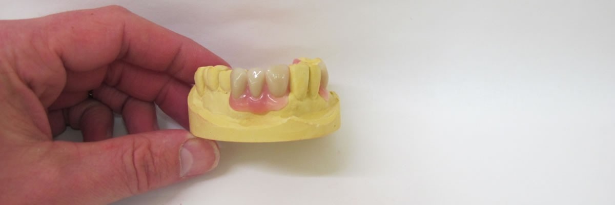 How To Make Dentures Step By Step Lyons OH 43533